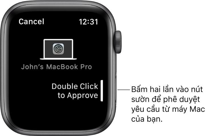 Apple Watch đang hiển thị một yêu cầu phê duyệt từ MacBook Pro.