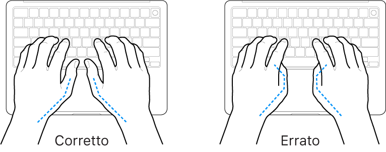 Mani posizionate su una tastiera che illustrano il posizionamento corretto ed errato dei pollici.