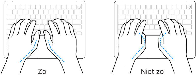 Handen boven een toetsenbord, waarbij de goede en verkeerde stand van de duimen wordt aangegeven.