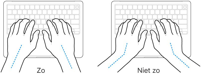 Handen boven een toetsenbord, waarbij de goede en verkeerde stand van de handen en polsen wordt aangegeven.