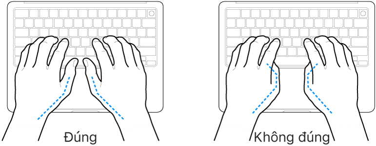 Các bàn tay đặt phía trên bàn phím, minh họa cách đặt ngón cái đúng và sai.