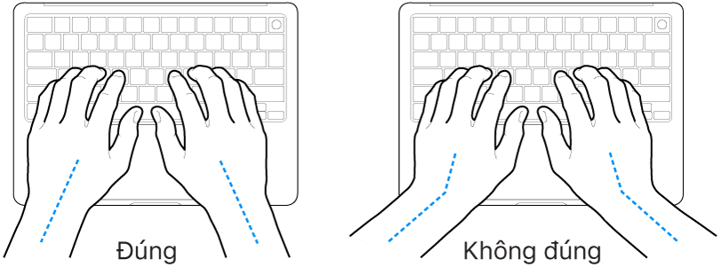 Các bàn tay đặt phía trên bàn phím, minh họa cách đặt cổ tay và bàn tay đúng và sai.