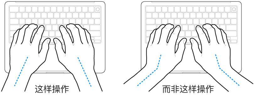 手掌放在键盘上方，显示手腕和手掌的正确对齐位置和错误对齐位置。