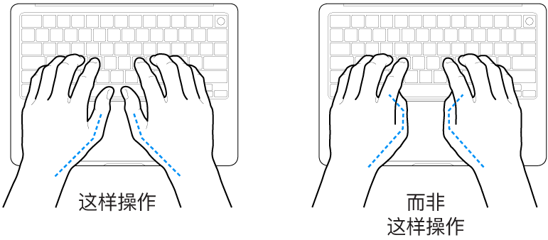 手掌放在键盘上方，显示拇指的正确放置和错误放置。