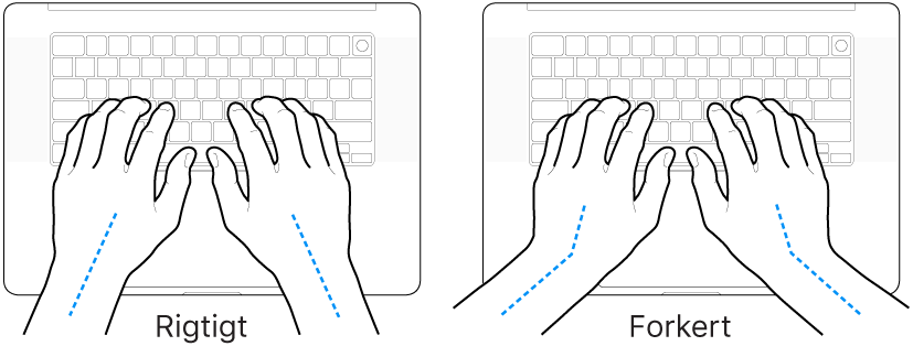 Hænder anbragt over et tastatur med rigtig og forkert position af håndled og hånd.