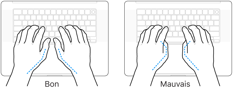 Mains placées sur un clavier, montrant la bonne et la mauvaise position des pouces.