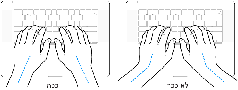 ידיים מעל מקלדת, להדגמת מנח נכון ומנח שגוי של כף היד ושורש כף היד.