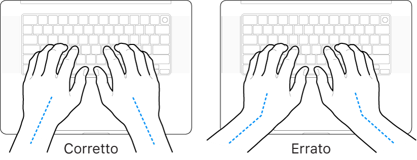 Mani posizionate su una tastiera che illustrano l’allineamento corretto ed errato di polso e mano.