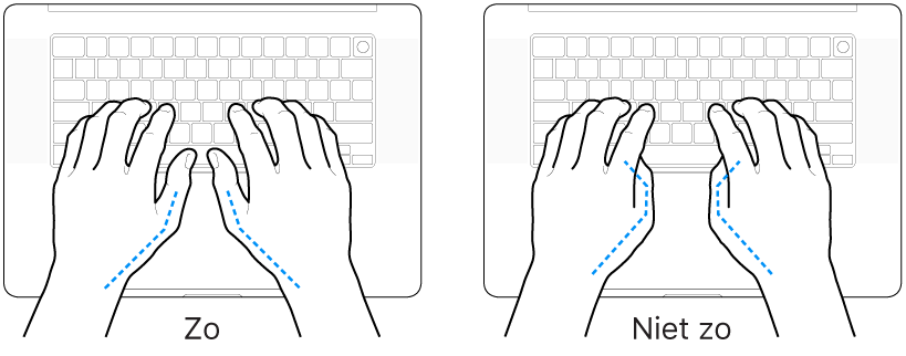 Handen boven een toetsenbord, waarbij de goede en verkeerde stand van de duimen wordt aangegeven.