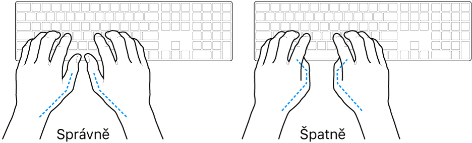 Ruce nad klávesnicí znázorňující správnou a nesprávnou polohu palců