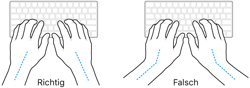 Tastatur und Hände in richtiger und falscher Haltung von Handgelenk und Händen