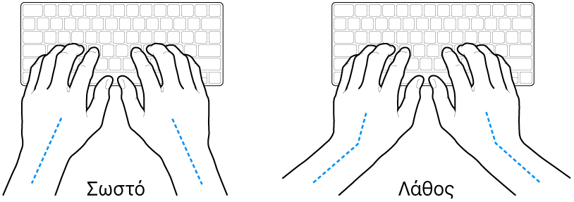 Χέρια τοποθετημένα επάνω σε ένα πληκτρολόγιο, που δείχνουν τη σωστή και τη λανθασμένη θέση των καρπών σε σχέση με τα χέρια.