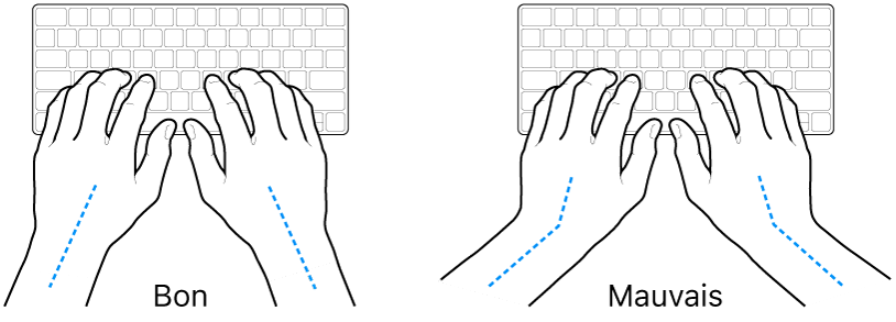 Mains placées sur un clavier, montrant le bon et le mauvais alignement des poignets et des mains.