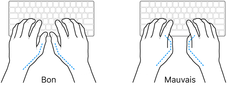 Mains placées sur un clavier, montrant la bonne et la mauvaise position des pouces.