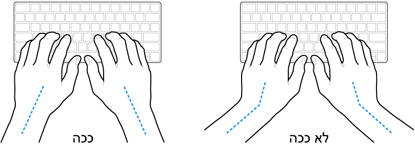 ידיים מעל מקלדת, להדגמת מנח נכון ומנח שגוי של כף היד ושורש כף היד.
