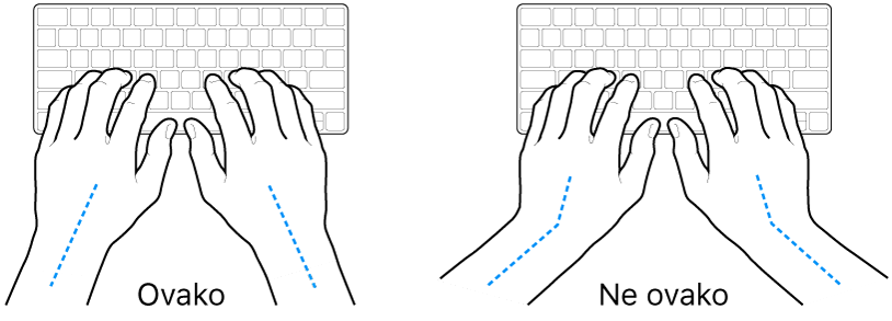 Ruke položene na tipkovnicu s prikazom pravilnog i nepravilnog položaja zapešća i ruku.