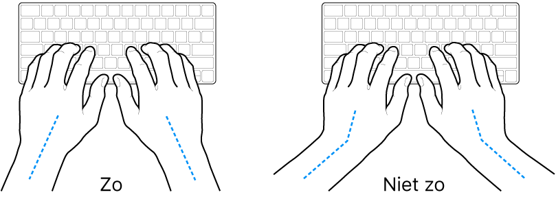 Handen boven een toetsenbord, waarbij de goede en verkeerde stand van de handen en polsen wordt aangegeven.