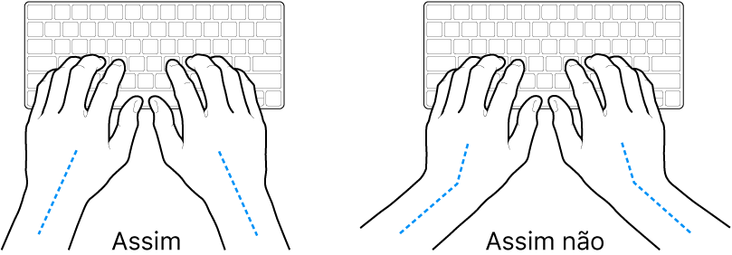 As mãos posicionadas sobre um teclado a mostrar alinhamentos corretos e incorretos das mãos e dos pulsos.