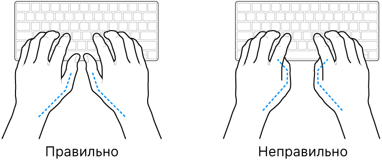 Руки розташовано над клавіатурою й показано правильне та неправильне положення великих пальців.