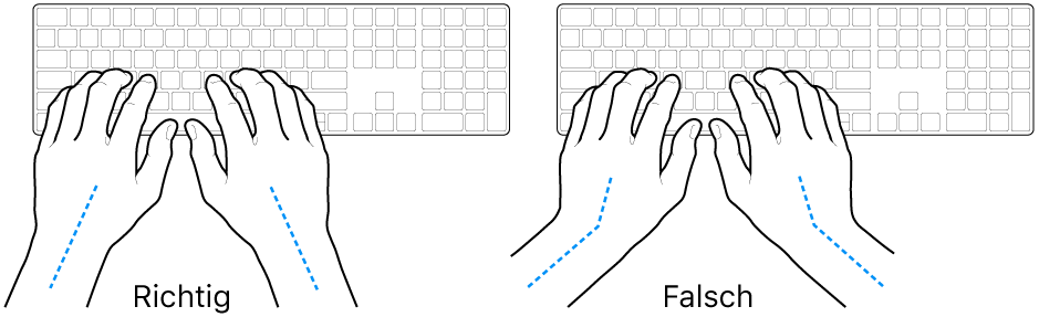 Tastatur und Hände in richtiger und falscher Haltung von Handgelenk und Händen