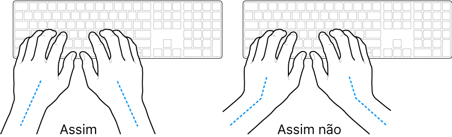 As mãos posicionadas sobre um teclado a mostrar alinhamentos corretos e incorretos das mãos e dos pulsos.