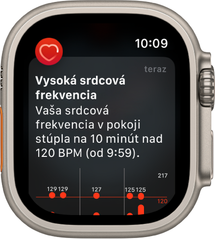 Obrazovka Vysoká srdcová frekvencia zobrazujúca hlásenie, že vaša srdcová frekvencia narástla nad 120 BPM na 10 minút, keď ste pravdepodobne nevykonával žiadnu aktivitu.