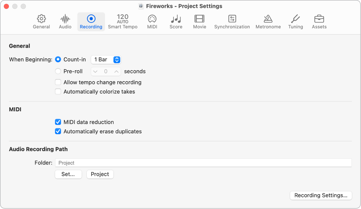 Figure. Recording project settings.