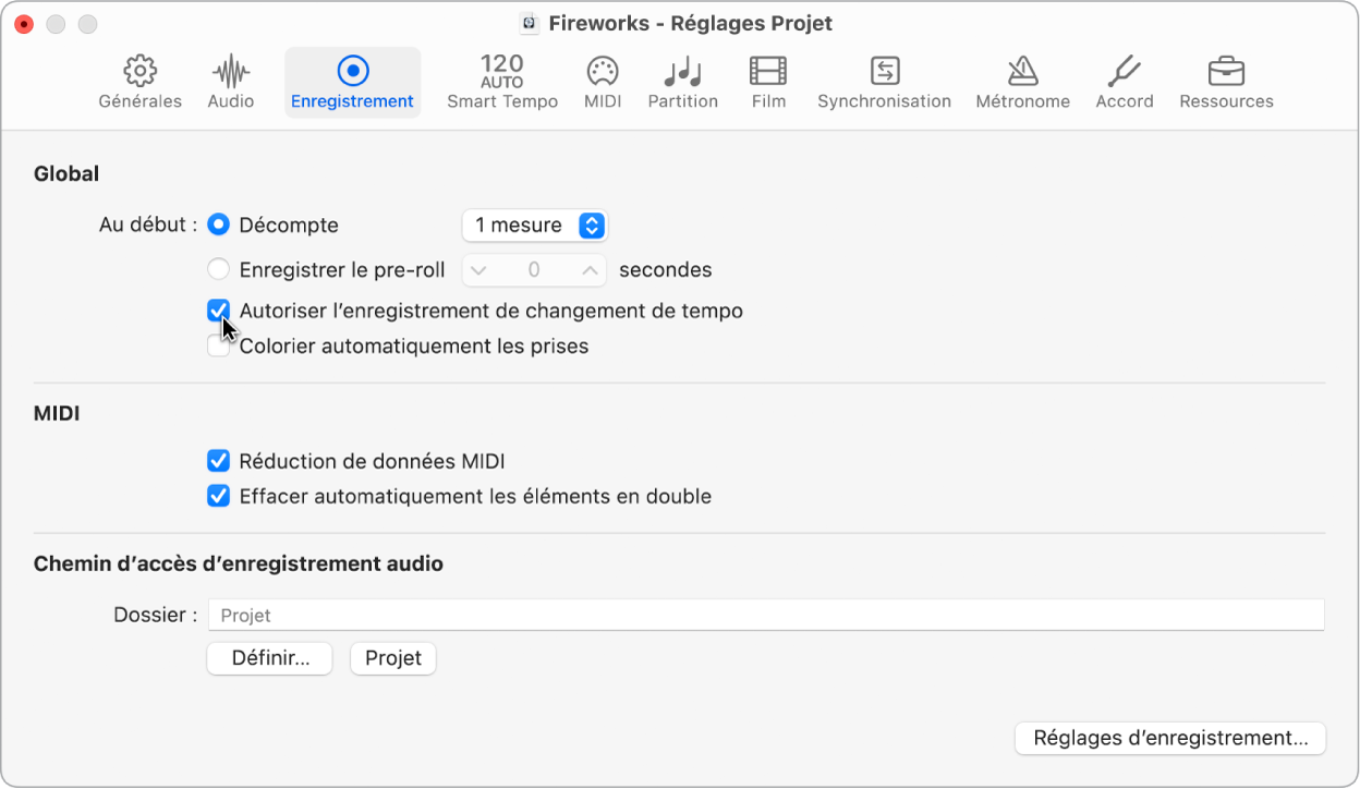 Figure. Sous-fenêtre Enregistrement des réglages de projet.