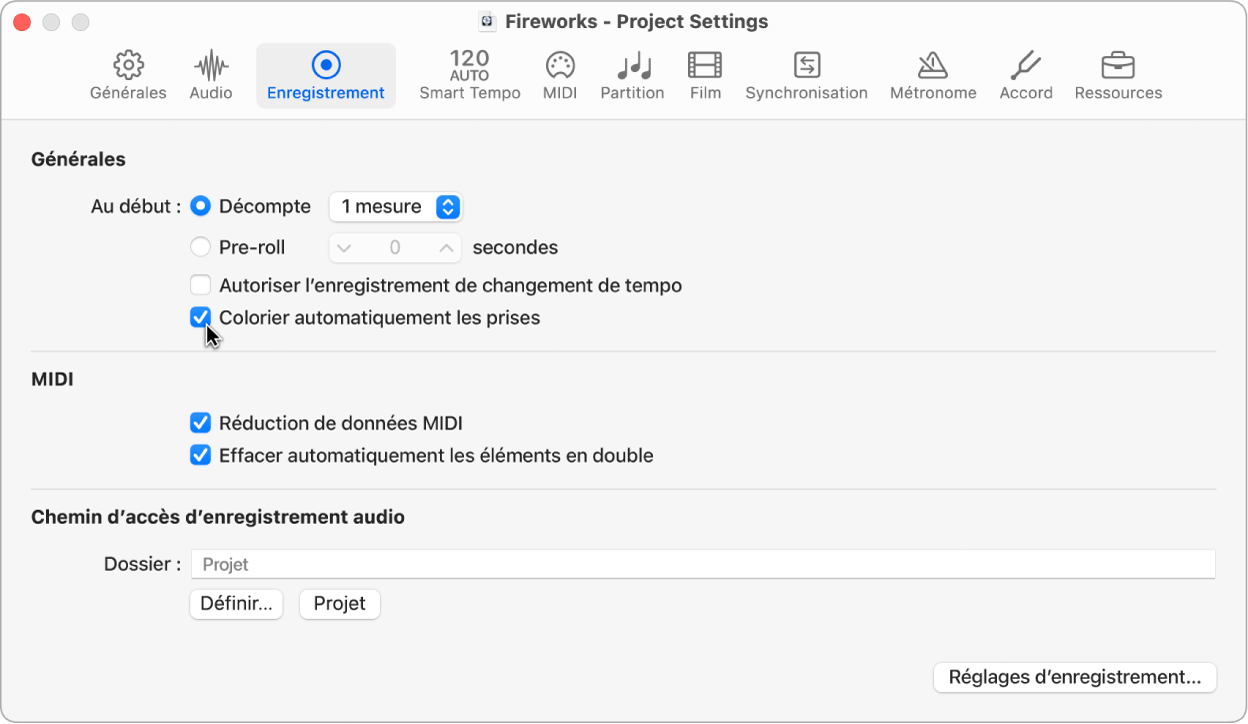 Figure. Sélection, dans la sous-fenêtre des réglages de projet d’enregistrement, de prises de couleur attribuée automatiquement.