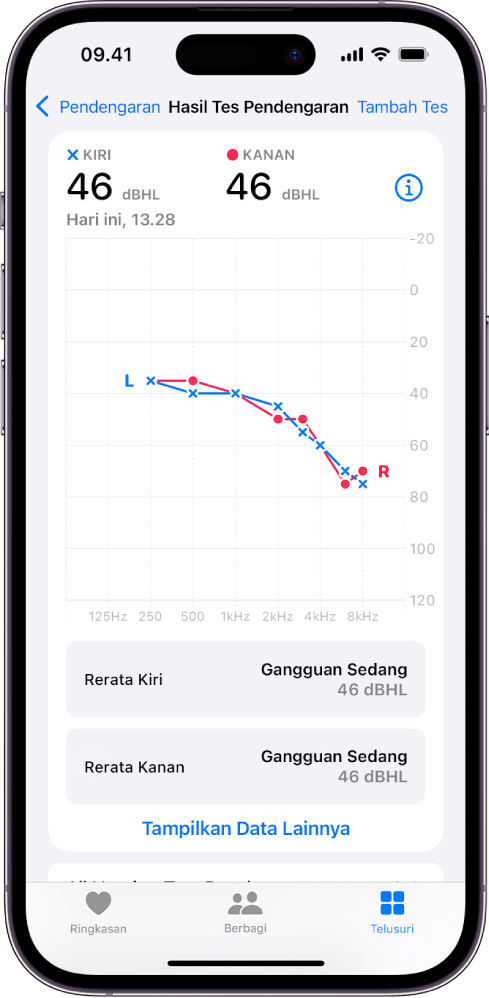 Audiogram di iPhone, yang menampilkan gangguan pendengaran sedang di kedua telinga.