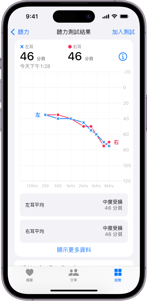 iPhone 上的聽力圖，顯示兩耳均為中度聽力受損。