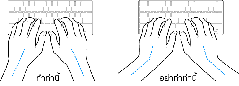 มือวางอยู่เหรือแป้นพิมพ์ แสดงตำแหน่งการวางข้อมือและแขนที่ถูกต้องและไม่ถูกต้อง
