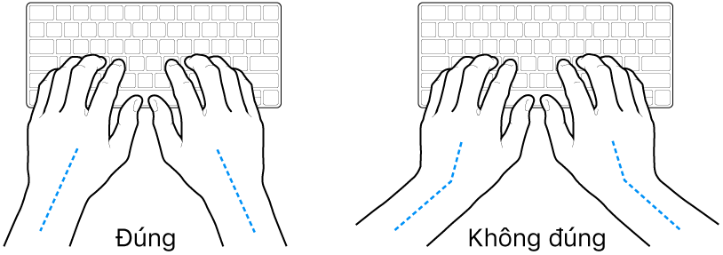 Các bàn tay đặt phía trên bàn phím, minh họa cách đặt cổ tay và bàn tay đúng và sai.