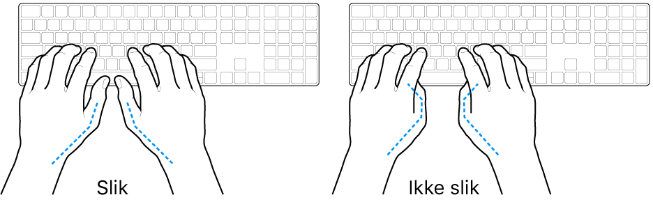 Hender plassert over et tastatur som viser riktig og feil tommelstilling.