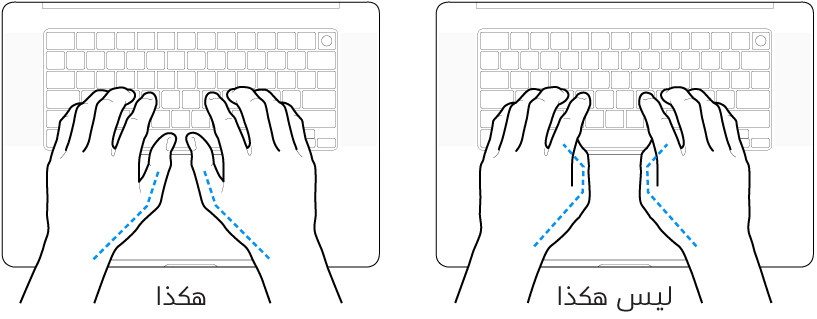 يدان موضوعتان على لوحة مفاتيح، ويظهر الوضع الصحيح وغير الصحيح للإبهامين.