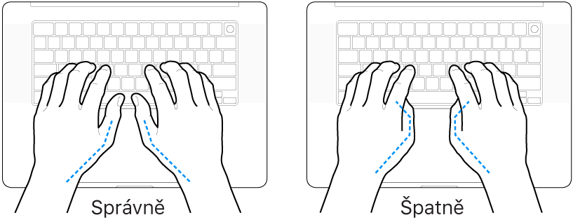 Ruce nad klávesnicí znázorňující správnou a nesprávnou polohu palců