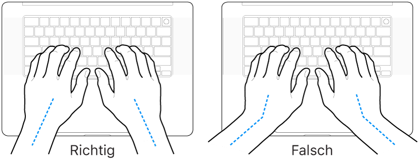 Tastatur und Hände in richtiger und falscher Haltung von Handgelenk und Händen