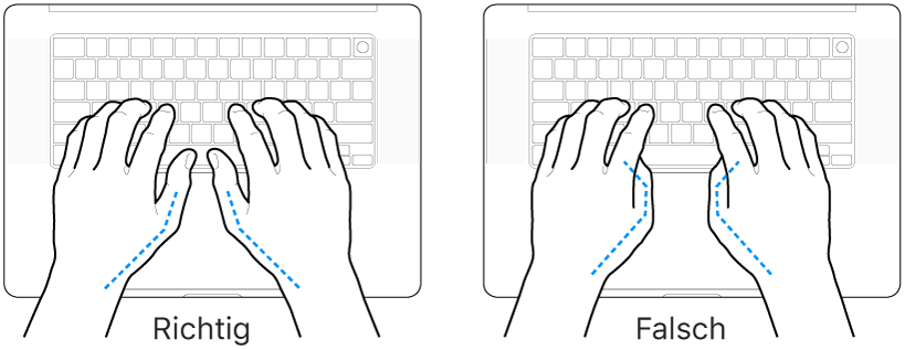 Tastatur und Hände in richtiger und falscher Haltung der Daumen