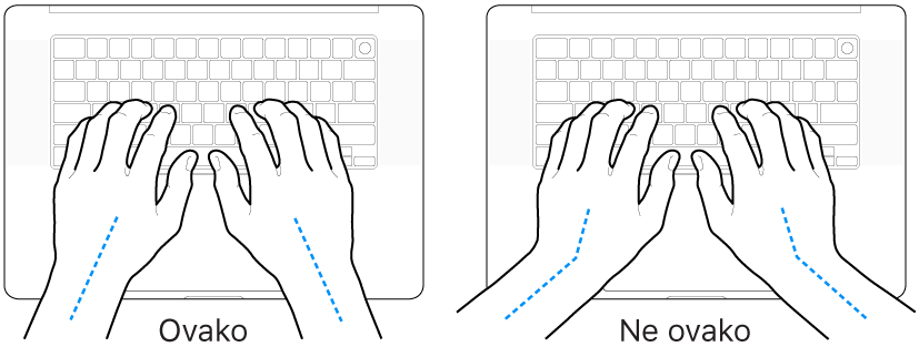 Ruke položene na tipkovnicu s prikazom pravilnog i nepravilnog položaja zapešća i ruku.