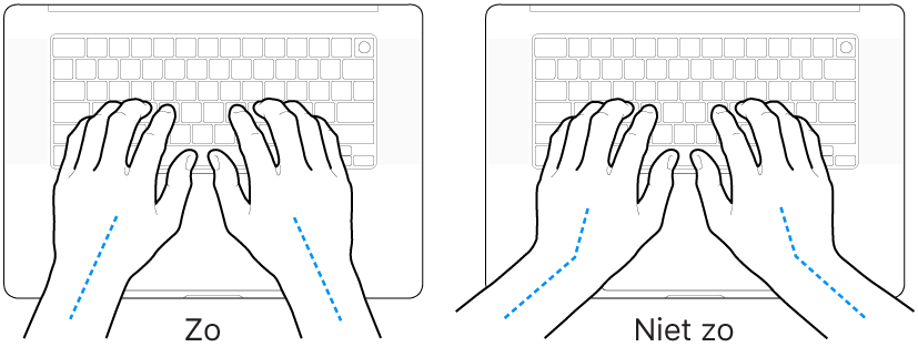 Handen boven een toetsenbord, waarbij de goede en verkeerde stand van de handen en polsen wordt aangegeven.