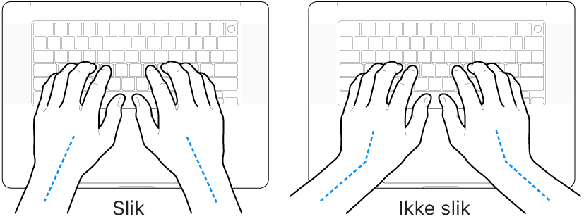 Hender plassert over et tastatur som viser riktig og feil stilling for håndledd og hender.
