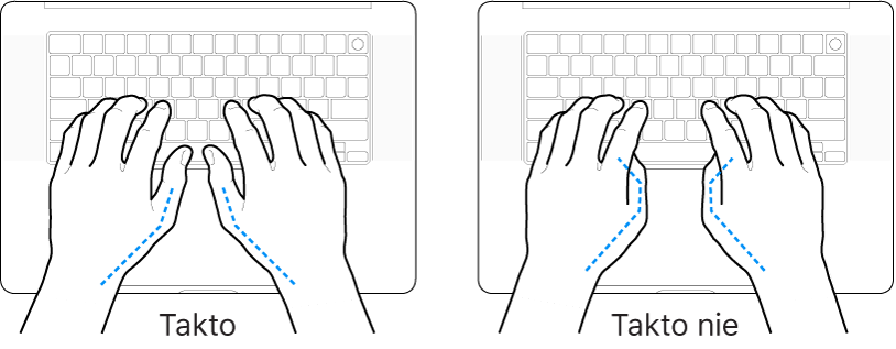 Ruky položené na klávesnici znázorňujúce správnu a nesprávnu polohu palcov.