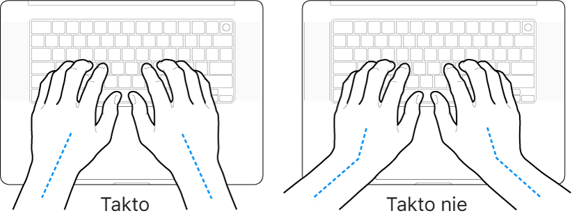 Ruky položené na klávesnici znázorňujúce správnu a nesprávnu polohu zápästia a ruky.