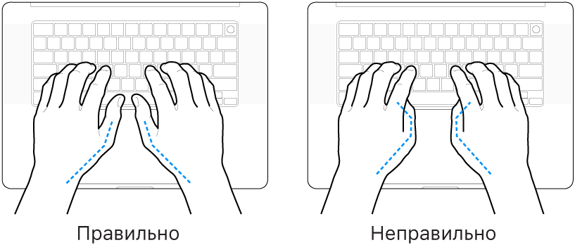 Руки розташовано над клавіатурою й показано правильне та неправильне положення великих пальців.