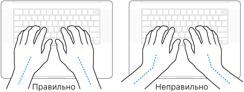 Руки розташовано над клавіатурою й показано правильне та неправильне положення кистей і рук.