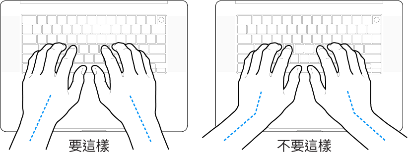 雙手置於鍵盤上，分別顯示正確與不正確的手肘與雙手對稱擺放位置。
