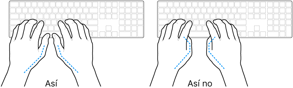 Manos colocadas sobre un teclado que muestran una posición correcta e incorrecta de los pulgares.