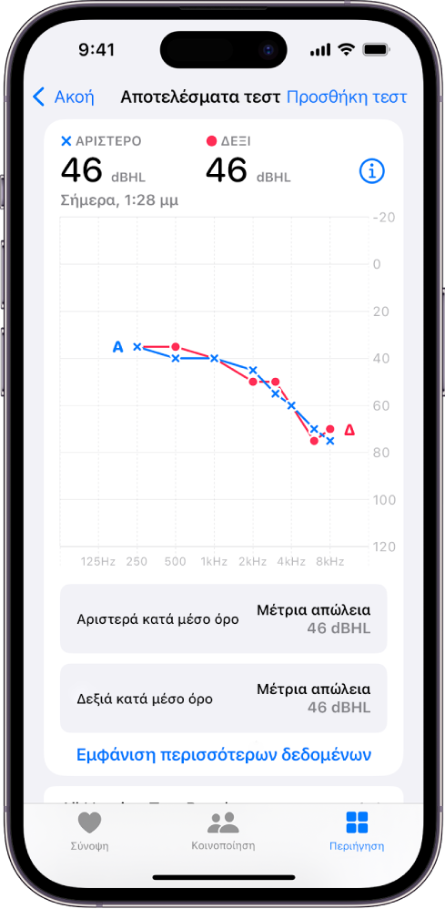 Ένα ακοόγραμμα στο iPhone, που δείχνει μέτρια απώλεια ακοής και στα δύο αυτιά.