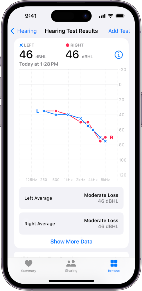 Audiogramma iPhone tālrunī, kurā redzams mērens dzirdes zudums abās ausīs.