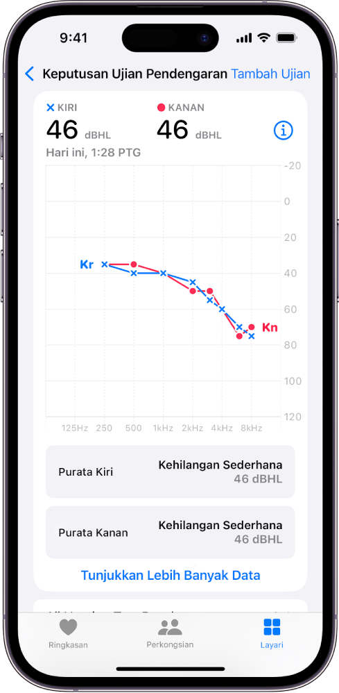 Audiogram pada iPhone, menunjukkan kehilangan pendengaran sederhana di kedua-dua telinga.